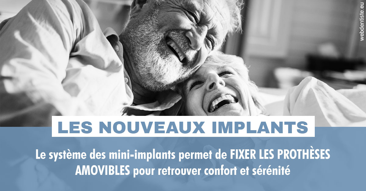 https://dr-le-gall-nicolas.chirurgiens-dentistes.fr/Les nouveaux implants 2
