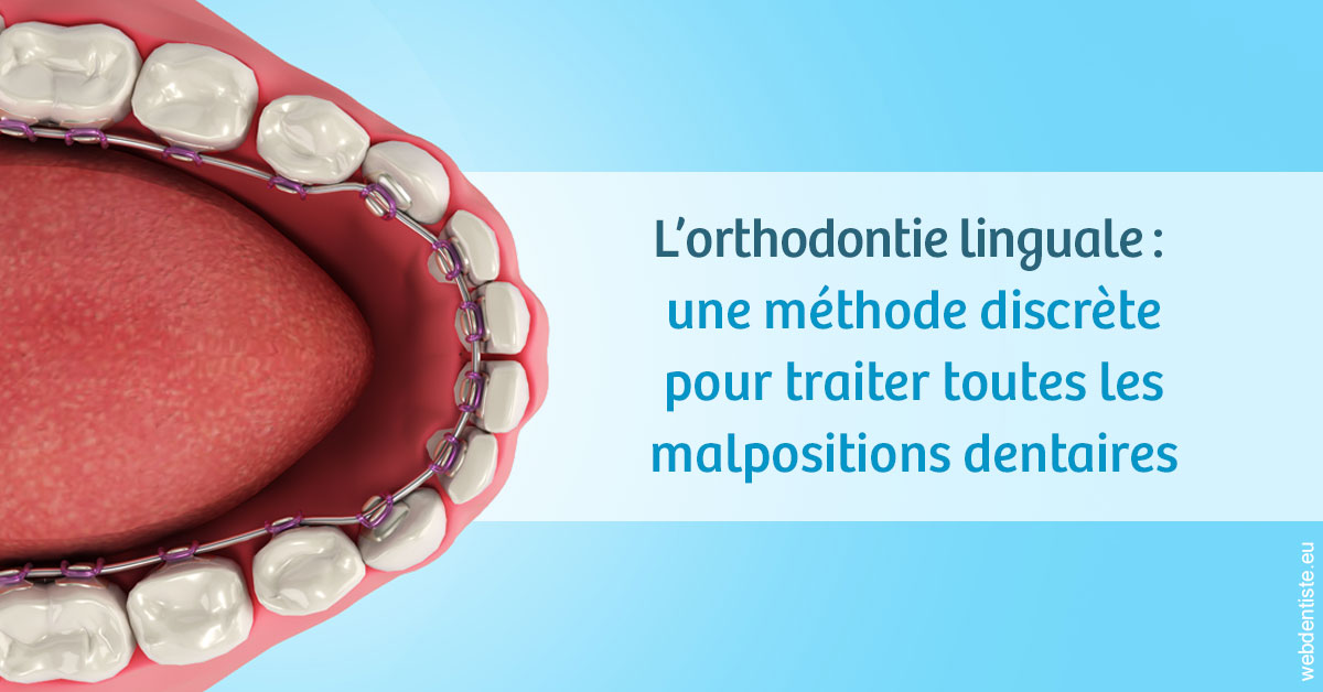 https://dr-le-gall-nicolas.chirurgiens-dentistes.fr/L'orthodontie linguale 1