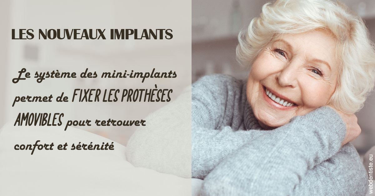 https://dr-le-gall-nicolas.chirurgiens-dentistes.fr/Les nouveaux implants 1