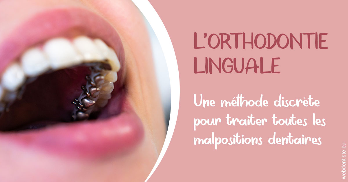 https://dr-le-gall-nicolas.chirurgiens-dentistes.fr/L'orthodontie linguale 2