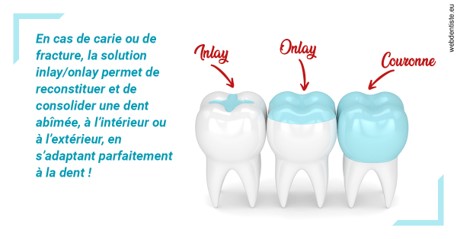 https://dr-le-gall-nicolas.chirurgiens-dentistes.fr/L'INLAY ou l'ONLAY
