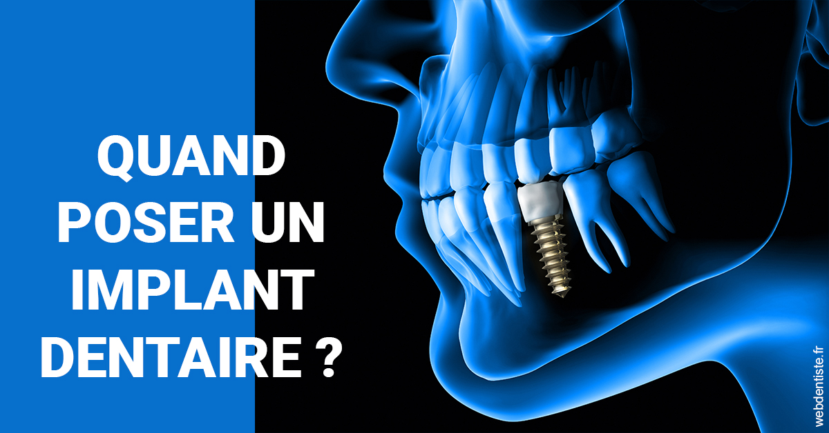 https://dr-le-gall-nicolas.chirurgiens-dentistes.fr/Les implants 1