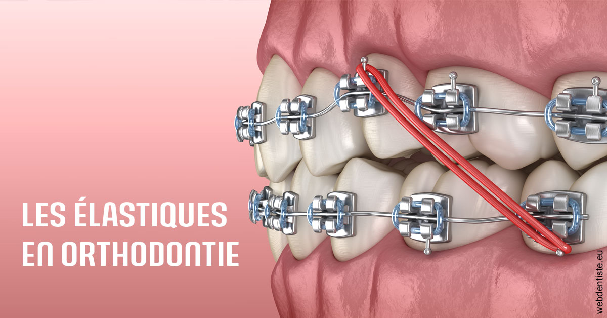 https://dr-le-gall-nicolas.chirurgiens-dentistes.fr/Elastiques orthodontie 2