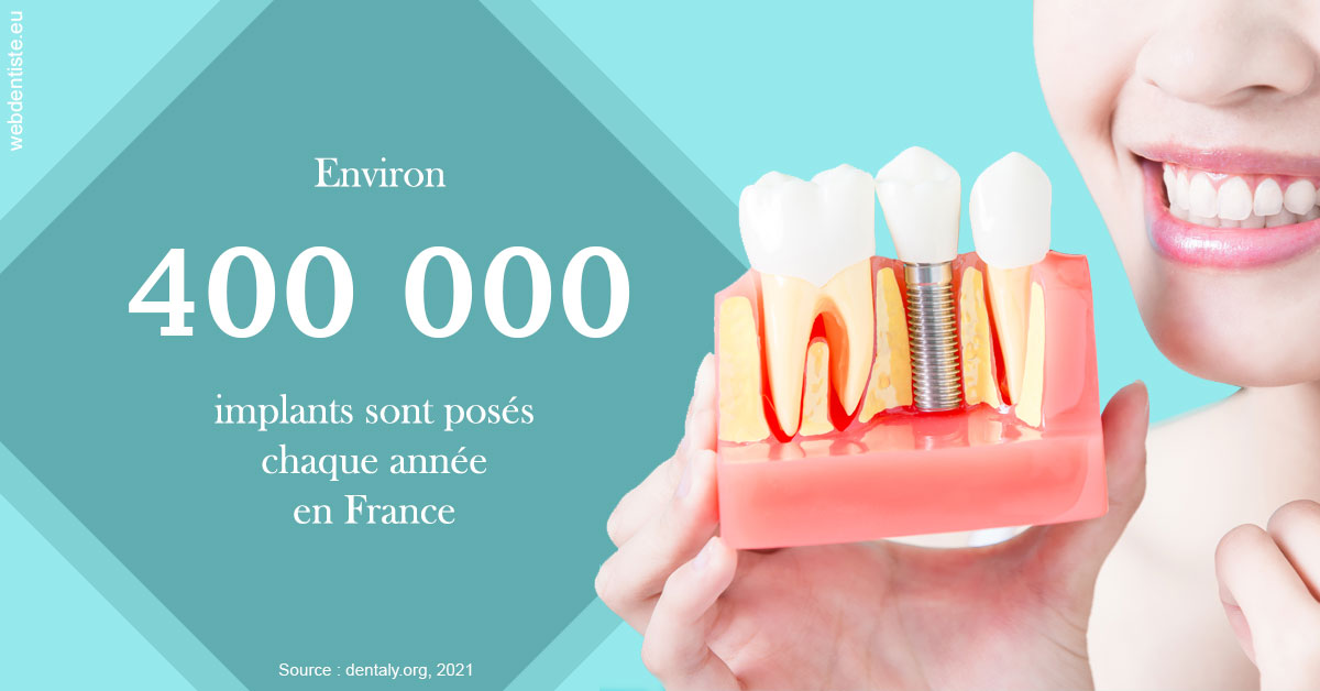 https://dr-le-gall-nicolas.chirurgiens-dentistes.fr/Pose d'implants en France 2