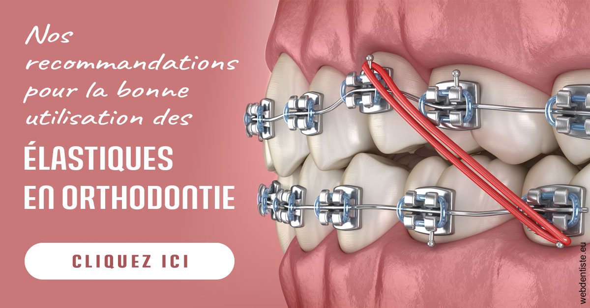 https://dr-le-gall-nicolas.chirurgiens-dentistes.fr/Elastiques orthodontie 2